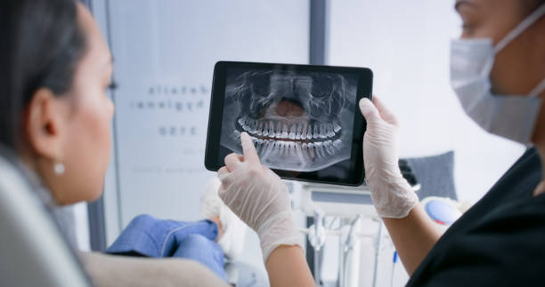 Licensed Tooth Extraction service in Montpelier, VT - Smile Center Dentistry